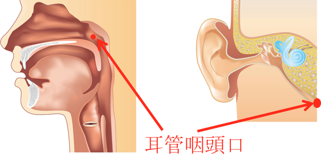 炎 慢性 上 咽頭